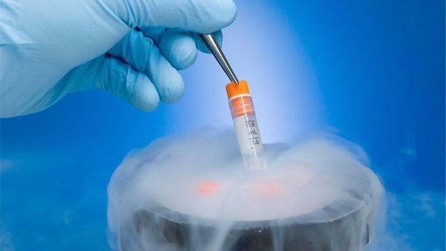 Sperm Freezing In Nagpur